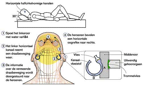 De Bárány calorische test.